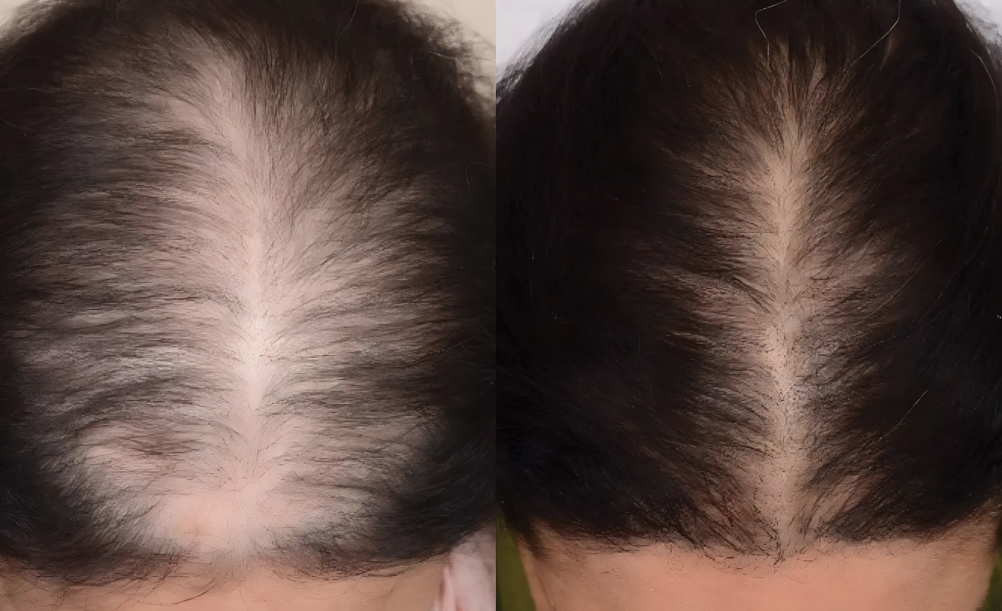 Rosemary Hair Oil-Biotin-Jojoba Butter,Vitamin H