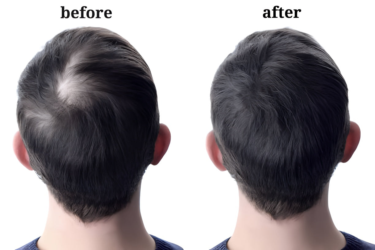Rosemary Hair Oil-Biotin-Jojoba Butter,Vitamin H